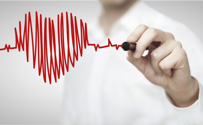 Healthcare spending and heart attack care